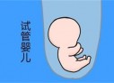 培养合肥捐卵宝宝艺术细胞的小技巧